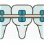 Braces & Aligners