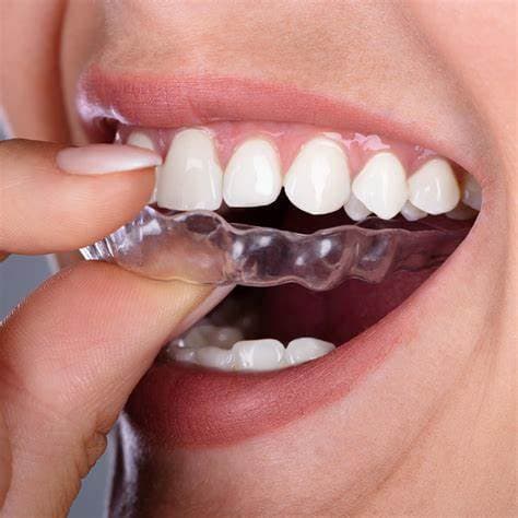 Orthodontics & Teeth Alignment