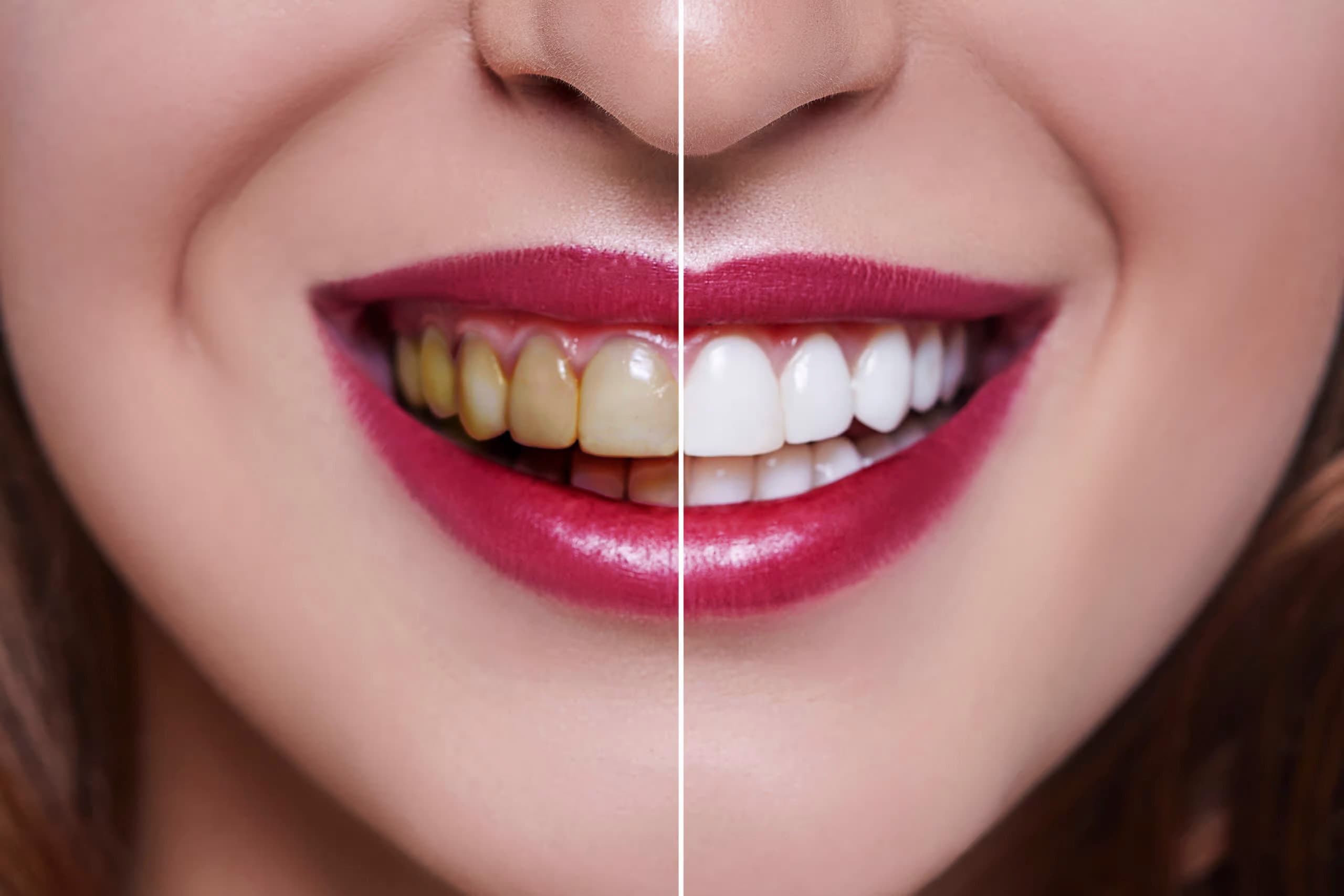 Cosmetic Dentistry